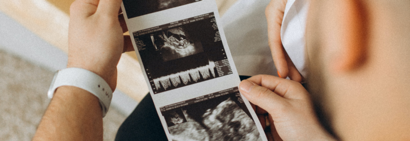 Family hold an ultrasound