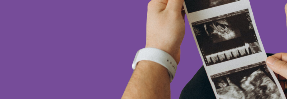 A close-up of an unidentified person looking at an ultrasound scan of a baby against a purple background